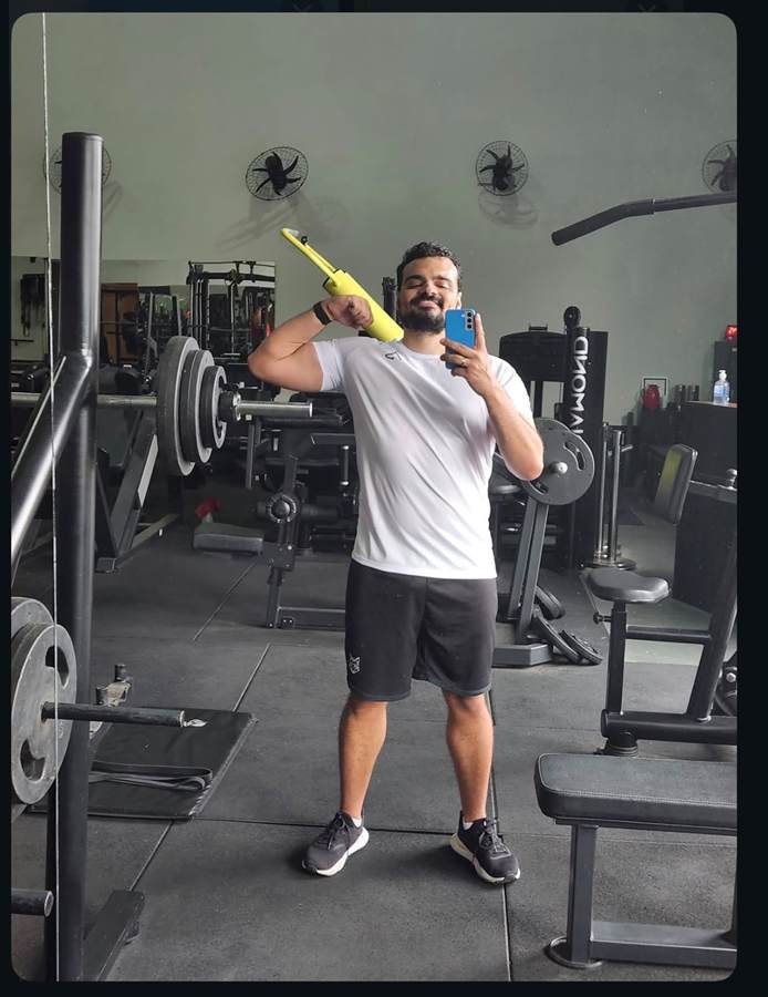 Igor Corrêa depois